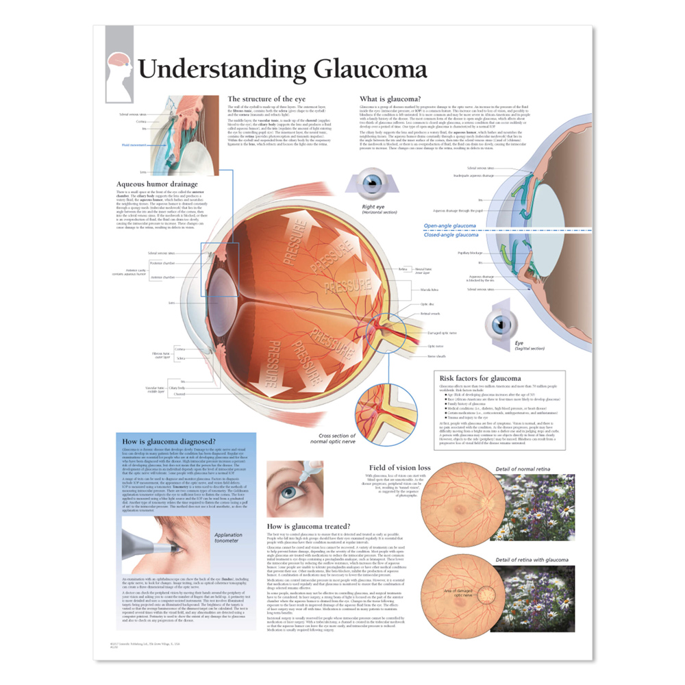Glaucoma Poster