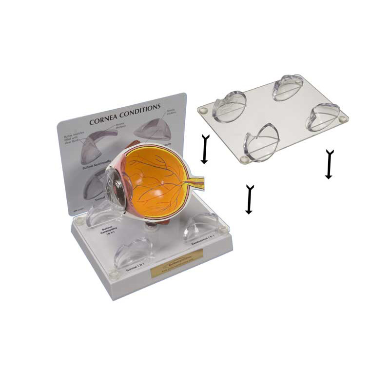 Lens Stabilizer for Cornea Model