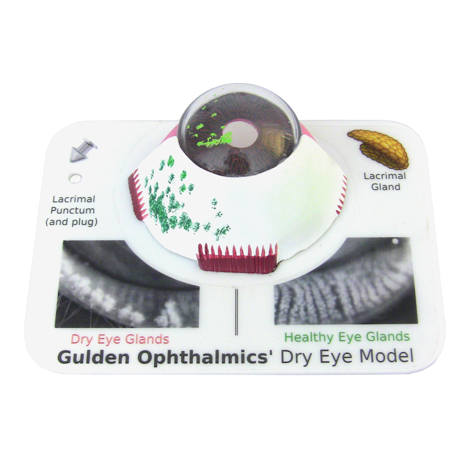Dry Eye Model