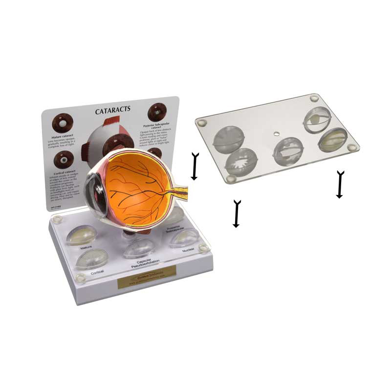 Lens Stabilizer for Cataract and IOL Models