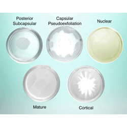 Demonstration Cataract Lenses