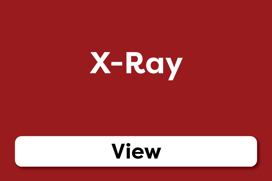 X-Ray